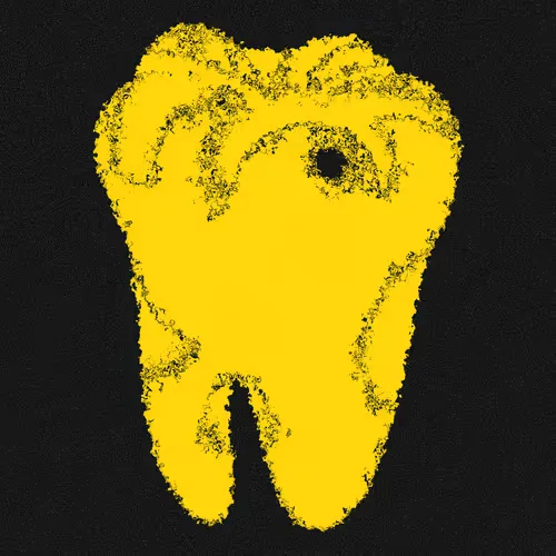 Gold Tooth